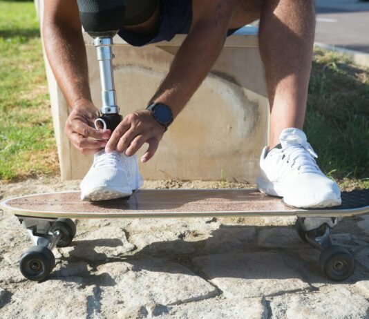 Retractable Ratchet Straps Reviewed: Which Brands Hold Up Under Pressure? Retractable Ratchet Straps Reviewed: Which Brands Hold Up Under Pressure?